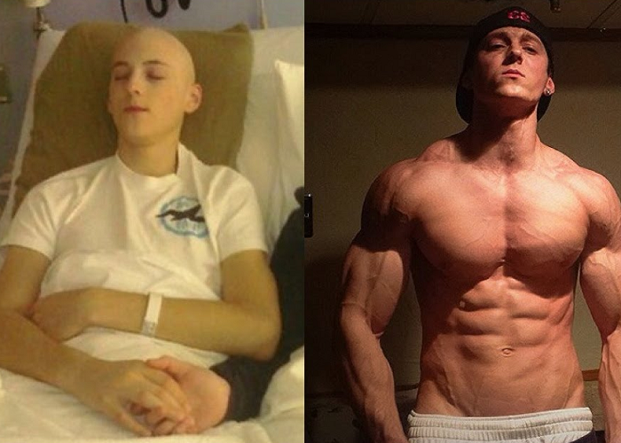 Watch This Amazing Transformation From Surviving Cancer To Becoming A Bodybuilder